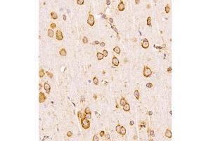 Immunohistochemistry analysis of paraffin-embedded human placenta using,CLIC6 (ABIN7073478) at dilution of 1: 600