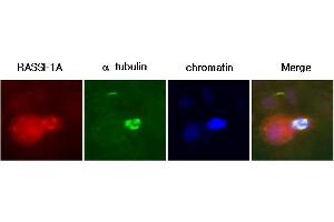 A431 cells were labeled with anti-RASSF1A (clone 3F3) mAb, and detection was using a biotinylated secondary antibody and Texas-red conj streptavidin.