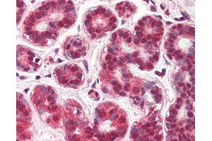 Anti-NUR77 antibody IHC of human breast. (NR4A1 antibody  (AA 401-414))