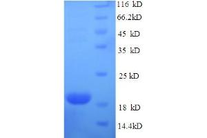SDS-PAGE (SDS) image for Interferon epsilon (IFNE) (AA 22-192) protein (His-SUMO Tag) (ABIN5711491) (IFNE Protein (AA 22-192) (His-SUMO Tag))