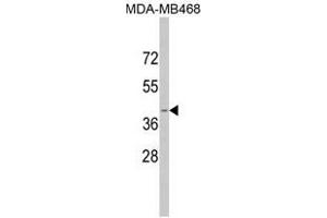 Image no. 1 for anti-Apolipoprotein L, 1 (APOL1) (BH3 Domain) antibody (ABIN452749) (APOL1 antibody  (BH3 Domain))