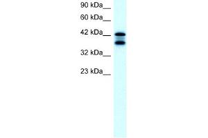 WB Suggested Anti-ACAT2 Antibody Titration:  2. (ACAT2 antibody  (Middle Region))