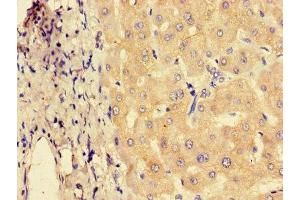 Immunohistochemistry of paraffin-embedded human liver tissue using ABIN7151230 at dilution of 1:100 (SYVN1 antibody  (AA 338-487))