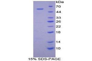 SDS-PAGE (SDS) image for Complement Factor D (CFD) (AA 1-253) protein (His tag,GST tag) (ABIN2122694) (Adipsin Protein (AA 1-253) (His tag,GST tag))