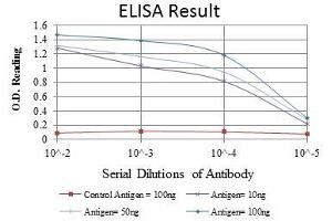 Red: Control Antigen (100 ng), Purple: Antigen (10 ng), Green: Antigen (50 ng), Blue: Antigen (100 ng), (SMN1 antibody)