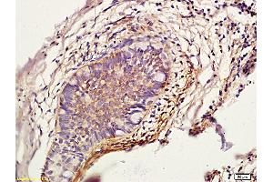 Formalin-fixed and paraffin embedded rat skin labeled with Anti-Cathepsin L/CTSL Polyclonal Antibody (ABIN687532), Unconjugated followed by conjugation to the secondary antibody and DAB staining (Cathepsin L antibody  (AA 71-170))