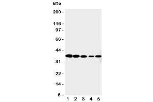 Western blot testing of Cdk7 antibody and Lane 1:  HeLa (CDK7 antibody  (C-Term))