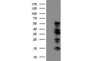 HEK293T cells were transfected with the pCMV6-ENTRY control (Left lane) or pCMV6-ENTRY WWTR1 (Right lane) cDNA for 48 hrs and lysed. (WWTR1 antibody)