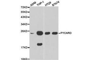 Western Blotting (WB) image for anti-Steroid Sulfatase (STS) antibody (ABIN1874484)