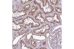 Immunohistochemical staining of human kidney with CLTA polyclonal antibody  shows strong membranous positivity in cells in tubules at 1:2500-1:5000 dilution. (CLTA antibody)