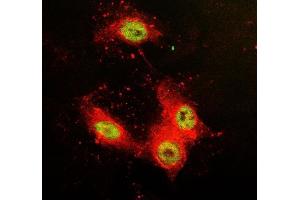 IF analysis of SFPQ using anti-SFPQ antibody (ABIN7603089) and anti-Tubulin Alpha antibody (ABIN7600339).