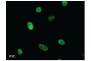 Immunostaining analysis in HeLa cells. (KIF22 antibody)