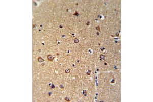 Immunohistochemistry (Paraffin-embedded Sections) (IHC (p)) image for anti-Ankylosis, Progressive Homolog (Mouse) (ANKH) (AA 464-492), (C-Term) antibody (ABIN653697)