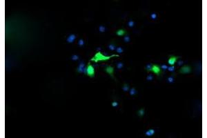 Image no. 3 for anti-Chromosome 2 Open Reading Frame 62 (C2orf62) antibody (ABIN1497051)