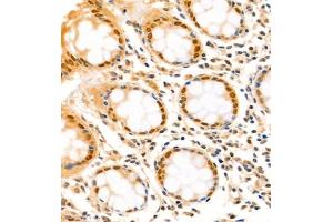 Immunohistochemistry analysis of paraffin-embedded human colon using,SATB2 (ABIN7075514) at dilution of 1: 1500 (SATB2 antibody)