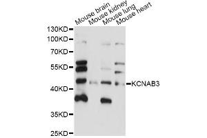 Western blot analysis of extracts of various cell lines, using KCNAB3 antibody (ABIN6292719) at 1:1000 dilution. (KCNAB3 antibody)