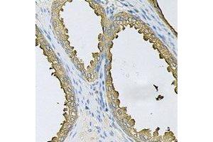 Immunohistochemical analysis of SRP19 staining in human prostate formalin fixed paraffin embedded tissue section. (SRP19 antibody)