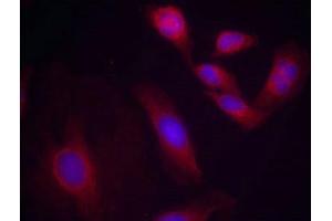 Immunofluorescence (IF) image for anti-Nuclear Factor-kB p65 (NFkBP65) (pSer536) antibody (ABIN7138649)