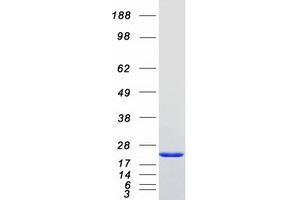 Validation with Western Blot