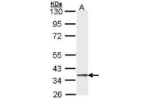 WB Image Sample (30 ug of whole cell lysate) A: Molt-4 , 10% SDS PAGE antibody diluted at 1:1000 (DMC1 antibody  (Center))