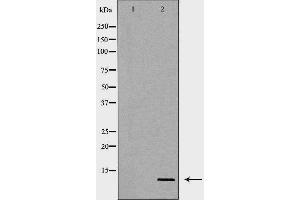 Western blot analysis of extracts of mouse lung , using SCGB1A1 antibody. (SCGB1A1 antibody  (Internal Region))