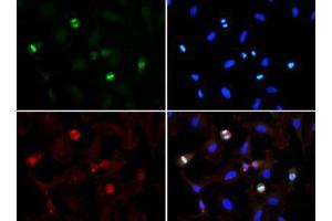 Immunofluorescence of Rabbit Anti-Histone H3 [Trimethyl Lys56] Antibody. (Histone 3 antibody  (H3K56me3))