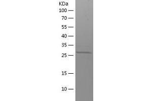 GRIN2B Protein (AA 1276-1484) (His tag)