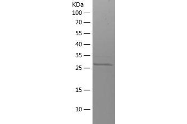 GRIN2B Protein (AA 1276-1484) (His tag)