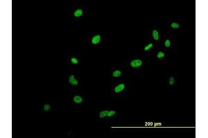 Immunofluorescence of purified MaxPab antibody to SAFB2 on HeLa cell. (SAFB2 antibody  (AA 1-528))