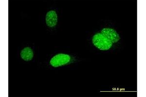 Immunofluorescence of monoclonal antibody to AURKB on HeLa cell.
