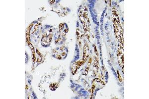 Immunohistochemistry of paraffin-embedded human placenta using APOE Rabbit pAb (ABIN6133561, ABIN6137017, ABIN6137019 and ABIN6213793) at dilution of 1:50 (40x lens). (APOE antibody  (AA 200-300))
