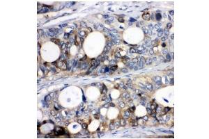 IHC analysis of Stathmin 1 using anti-Stathmin 1 antibody (ABIN3043301). (Stathmin 1 antibody  (N-Term))