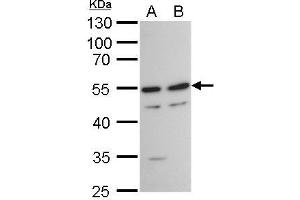WB Image TAF7 antibody detects TAF7 protein by western blot analysis.