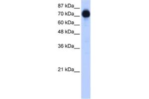 Western Blotting (WB) image for anti-Zinc Finger Protein 16 (ZNF16) antibody (ABIN2461808) (ZNF16 antibody)