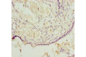 IHC analysis of paraffin-embedded human placenta tissue, using POUF43 antibody (1/100 dilution). (POU4F3 antibody  (AA 1-180))
