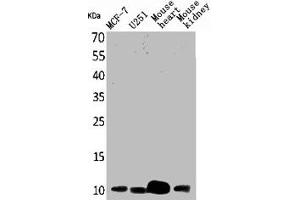 Western Blot analysis of MCF7 U251 mouse liver mouse kidney cells using ACBP Polyclonal Antibody (Diazepam Binding Inhibitor antibody  (C-Term))