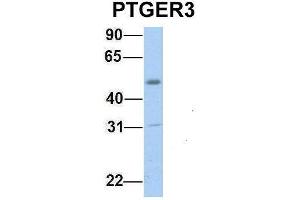 Host:  Rabbit  Target Name:  PTGER3  Sample Type:  Human Fetal Muscle  Antibody Dilution:  1. (PTGER3 antibody  (C-Term))