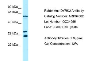 Western Blotting (WB) image for anti-Dual-Specificity tyrosine-(Y)-phosphorylation Regulated Kinase 2 (DYRK2) (C-Term) antibody (ABIN970575) (DYRK2 antibody  (C-Term))