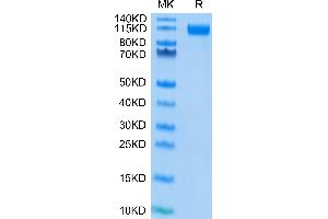 SARS-COV-2 Spike S1 (D614G) on Tris-Bis PAGE under reduced condition. (SARS-CoV-2 Spike S1 Protein (D614G) (His-Avi Tag))