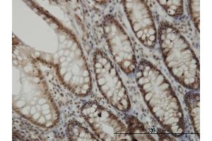Immunoperoxidase of monoclonal antibody to CDK6 on formalin-fixed paraffin-embedded human colon. (CDK6 antibody  (AA 3-99))
