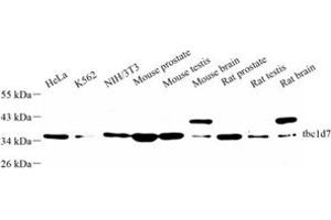 Western blot analysis of tbc1d7 (ABIN7075849) at dilution of 1: 500
