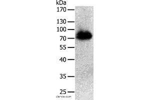 Western blot analysis of Human liver cancer tissue, using PRMT7 Polyclonal Antibody at dilution of 1:500 (PRMT7 antibody)