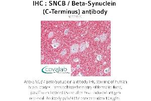 Image no. 1 for anti-Synuclein, beta (SNCB) antibody (ABIN1739479) (beta Synuclein antibody)