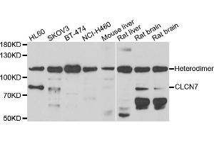 Western blot analysis of extracts of various cell lines, using CLCN7 antibody. (CLCN7 antibody)