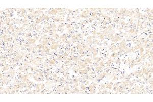 Detection of SCGB2A2 in Human Mammary gland Tissue using Polyclonal Antibody to Secretoglobin Family 2A, Member 2 (SCGB2A2) (Mammaglobin A antibody  (AA 19-93))