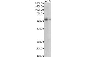 ABIN5855385 (1 µg/ml) staining of Human Placenta (A) and Human Adrenal Gland (B) lysate (35 µg protein in RIPA buffer). (SLC18A2 antibody)