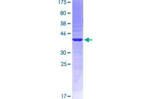 EMILIN2 Protein (AA 121-230) (GST tag)