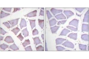 Immunohistochemistry analysis of paraffin-embedded human skeletal muscle, using XIAP (Phospho-Ser87) Antibody. (Intestinal Alkaline Phosphatase antibody  (pSer87))