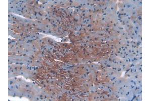 IHC-P analysis of Mouse Heart Tissue, with DAB staining. (IGF2R antibody  (AA 1148-1365))