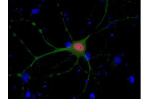 Indirect immunostaining of PFA fixed rat hippocampus neurons with anti-Ctip 2 (dilution 1 : 500; red) and mouse anti-MAP 2 (, dilution 1 : 500; green). (BCL11B antibody  (AA 541-812))